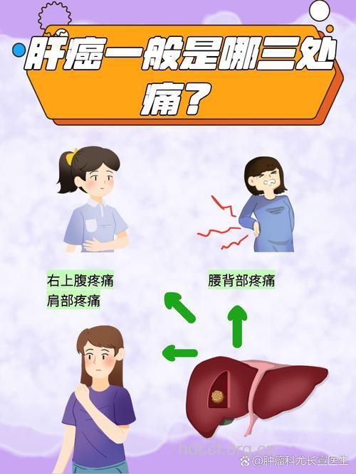 肝癌患者的疼痛有什么特点