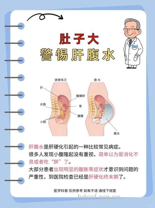 肝腹水有转化为肝癌的危险