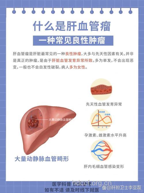 肝血管瘤是怎么形成的?