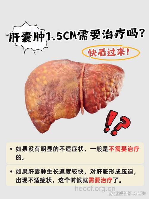 肝囊肿能治愈吗