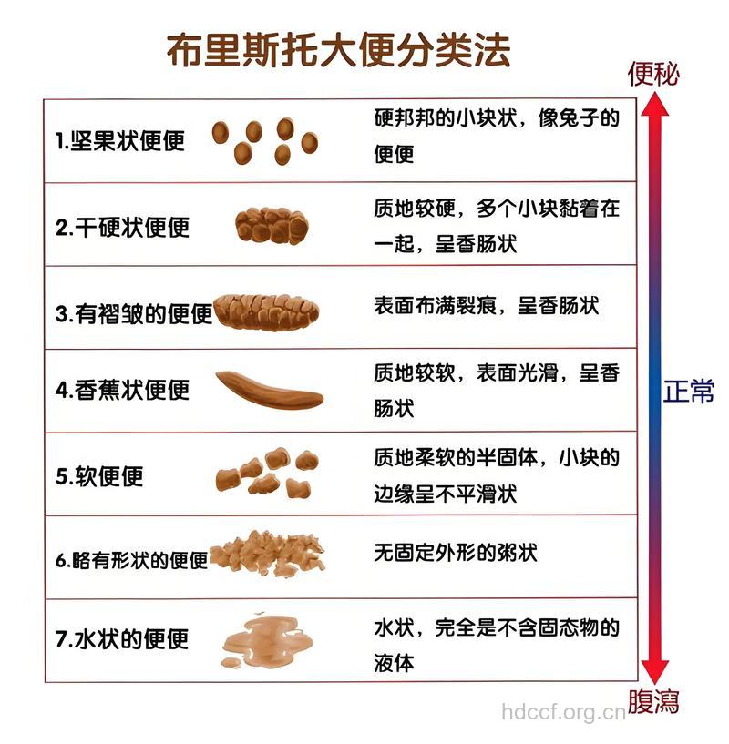 大便如何分类 布里斯托大便分类法
