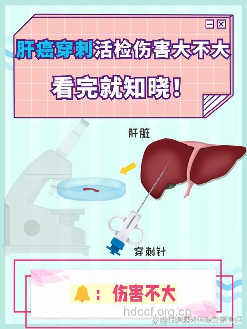 肝癌早期有哪些检查手段