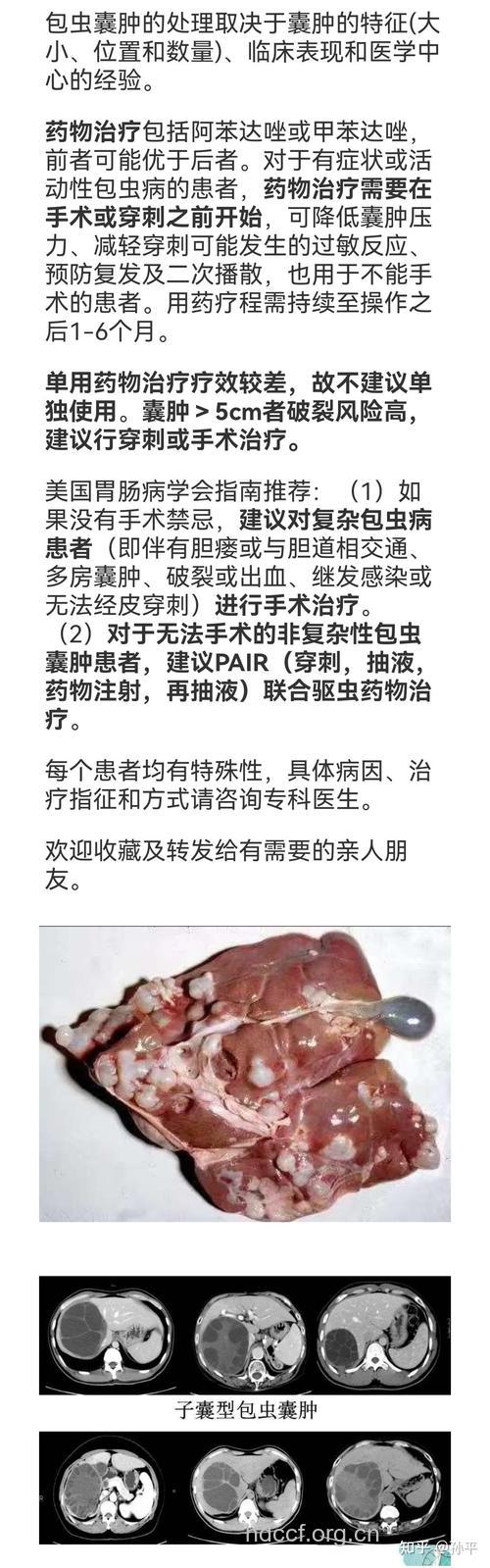 肝包虫病治疗方法