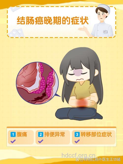 肠癌的晚期症状