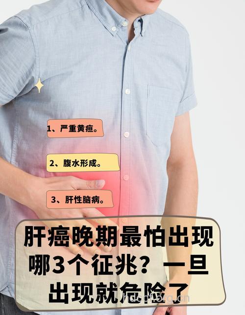 肝癌有哪些特殊表现呢