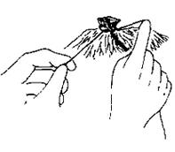 什么是药线结扎方法