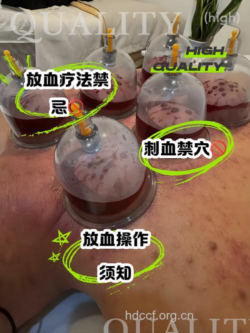 什么是中医刺血疗法