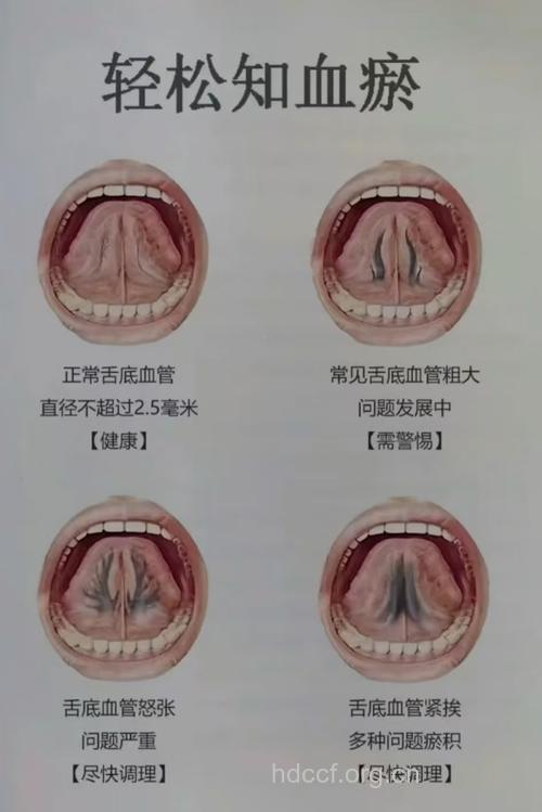什么是中医舌下给药法