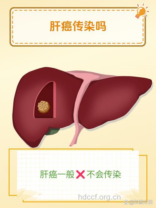 该如何区别原发性和继发性肝癌