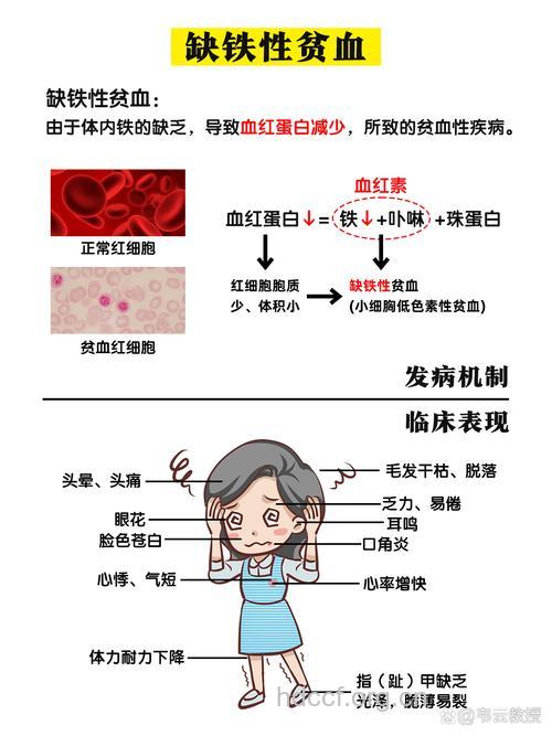 缺铁性贫血|缺铁性贫血的症状