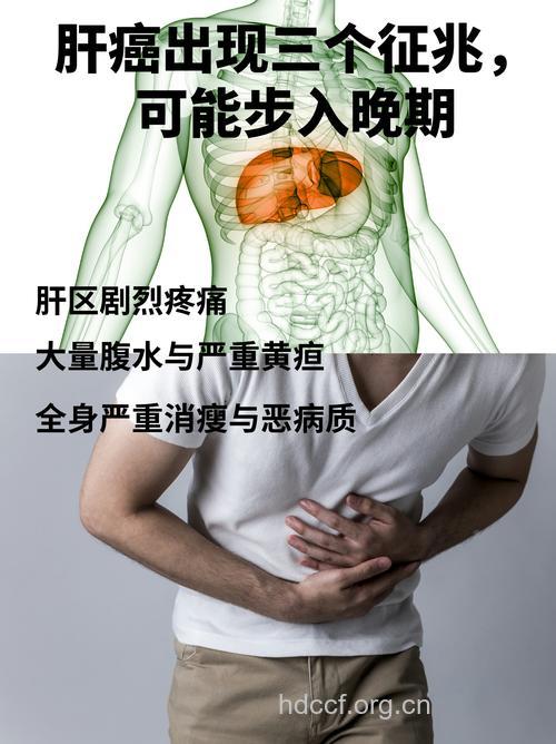 肝癌临床表现及如何诊断