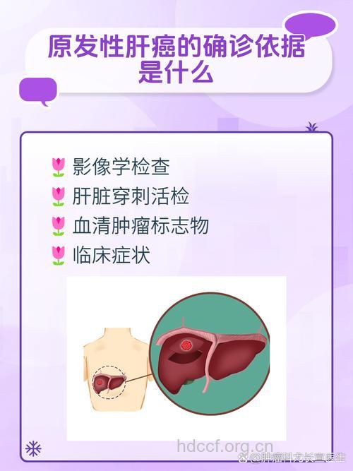 肝癌的预防发现诊断治疗