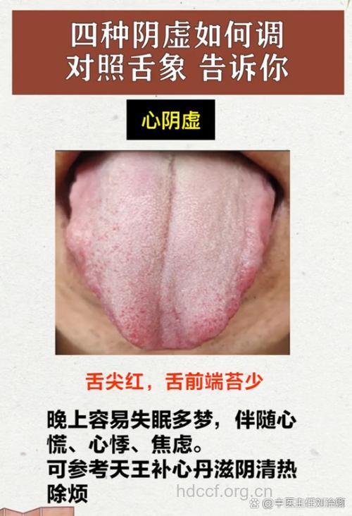 什么是心阴虚证？