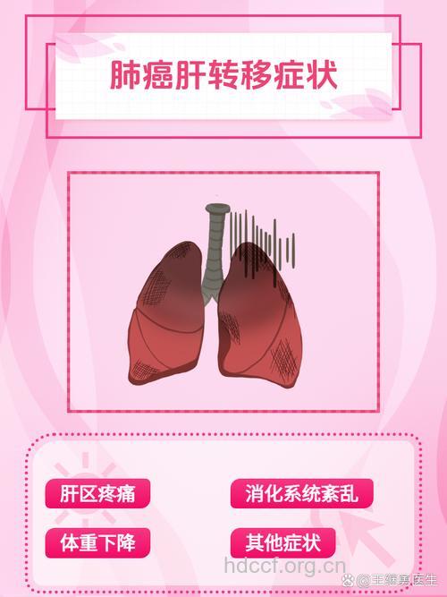 肝癌转移症状有哪些?