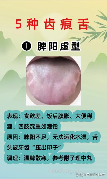 什么是脾阳虚证？