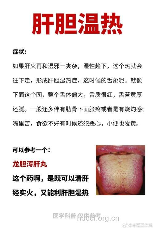 什么是肝郁气滞证？