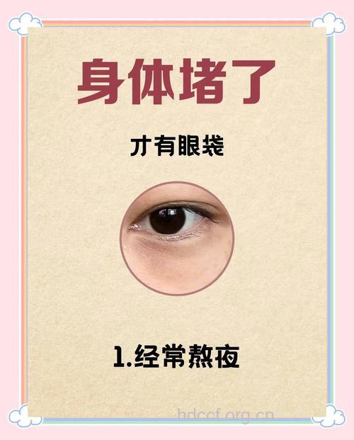 春节熬夜有眼袋？5个妙招轻松去除