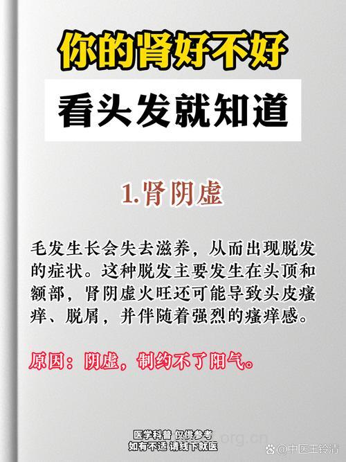 脱发就是肾虚导致?补肾就可以吗