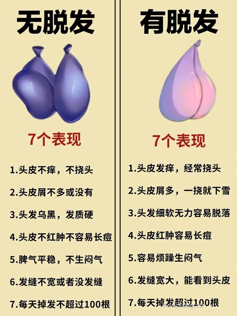 脱发有前兆 出现这些问题要小心