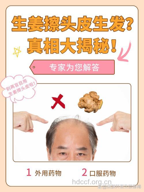 脱发掉发很烦恼 生姜秘招能生发
