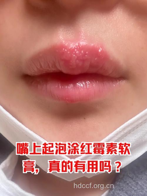 闪亮口红伤唇,小心铋中毒