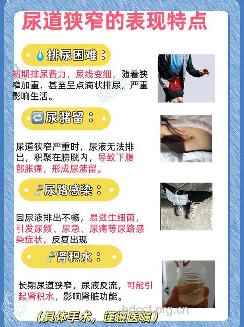 尿道狭窄该如何治疗?