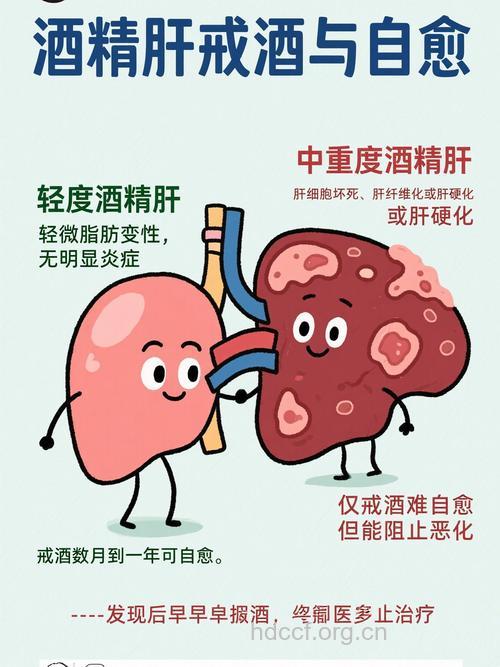 饮酒多而频,小心脂肪肝