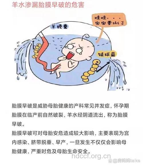 羊水早破居家紧急处理法