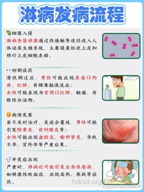 如何判断是否得了淋病?