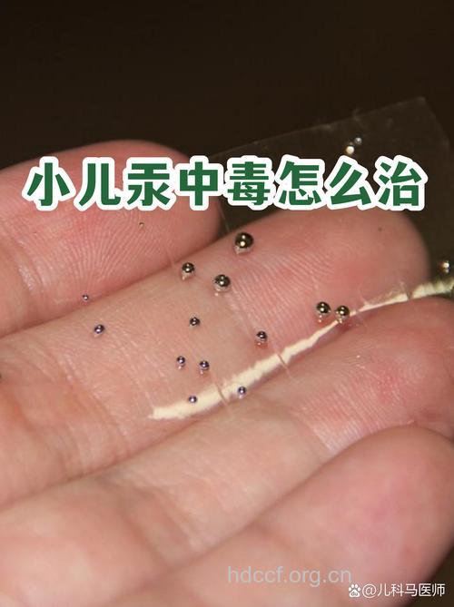 小儿高锰酸钾中毒后的治疗