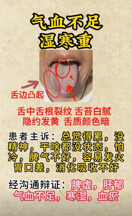 强碱类中毒的中医辨证