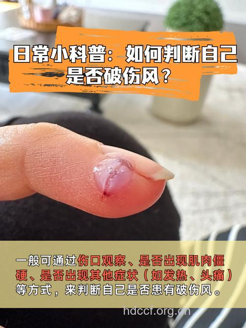 如何判断是否得了破伤风？