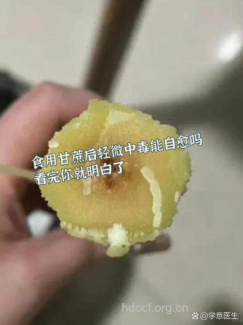 霉变甘蔗中毒有哪些症状?