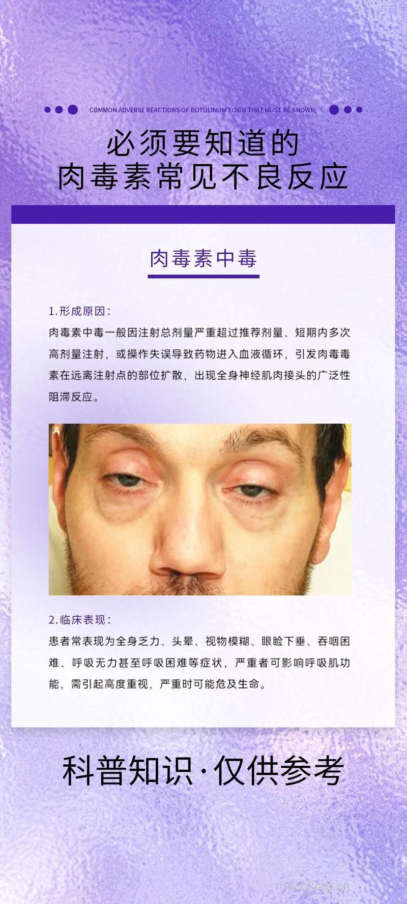 夏季为什么会导致肉毒中毒