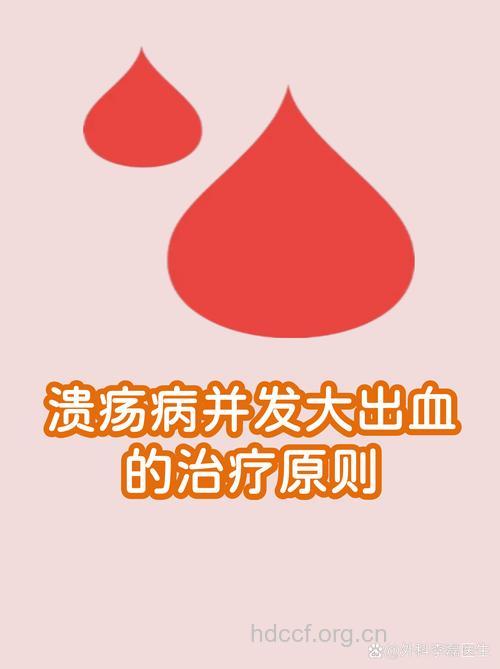 溃疡病出血 首选保守治疗