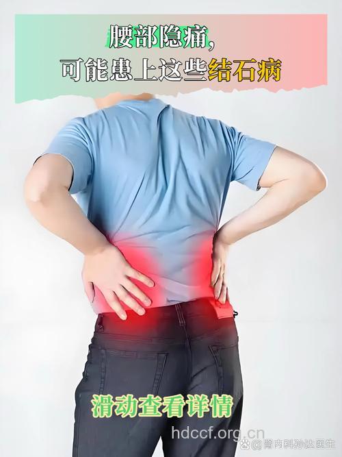 青年男性突发腰部绞痛 小心肾结石