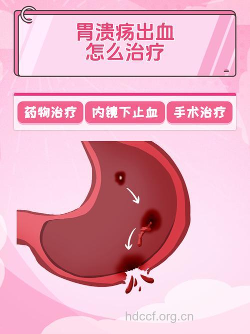 应激性溃疡大出血哪些需要手术治疗?