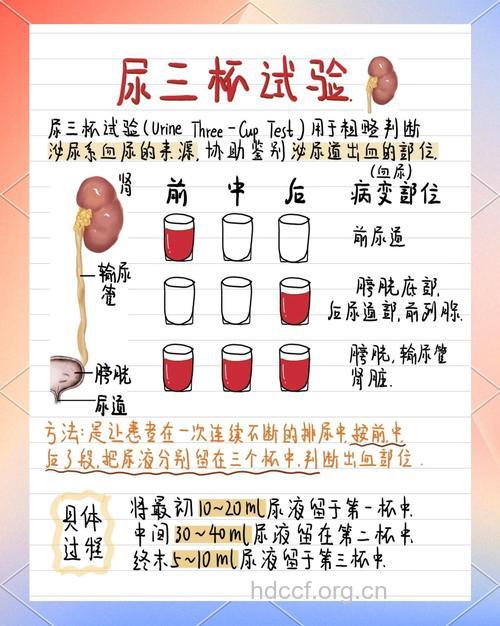 尿三杯试验可明确血尿发生的部位