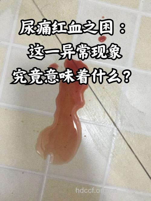 哪些情况会出现血尿?