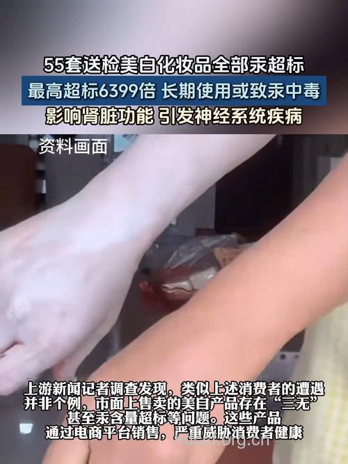 用美白产品小心铅汞中毒