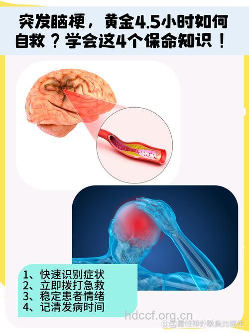 大脑中动脉血栓的急救方法