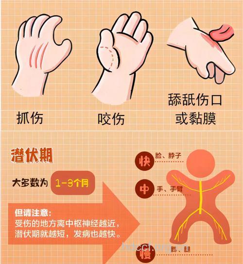 被猫狗等动物咬伤后要如何自救