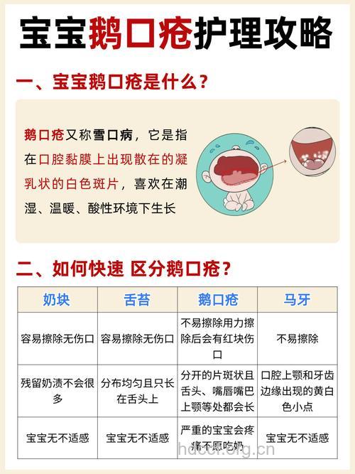 宝宝出现鹅口疮怎么办？