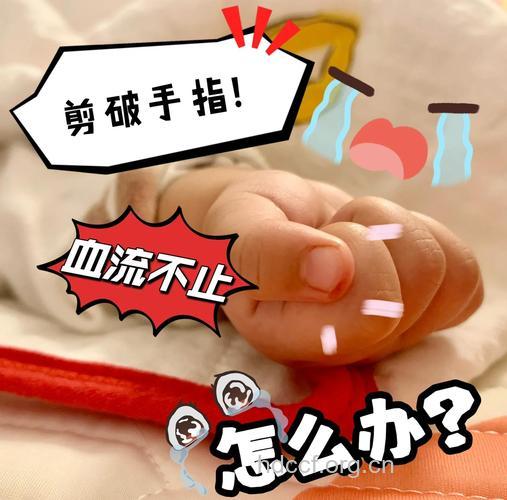 宝宝手指夹伤怎么办?