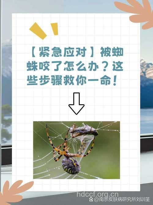 被蜘蛛咬伤怎样急救