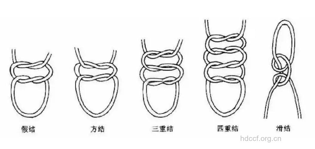 肠“打结”的四大特征