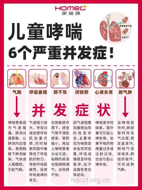 小儿反复喘息 需警惕哮喘