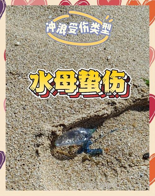水母刺伤后如何急救