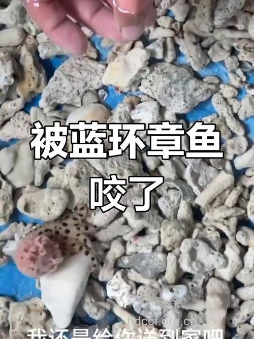 章鱼咬伤怎么紧急处理