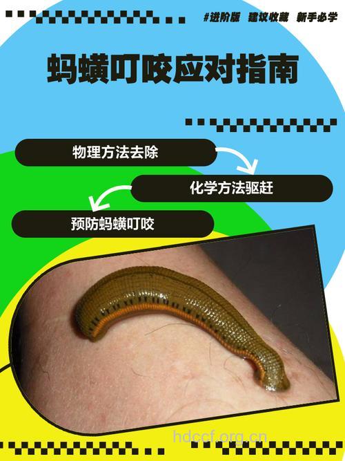 蚂蟥咬伤如何急救